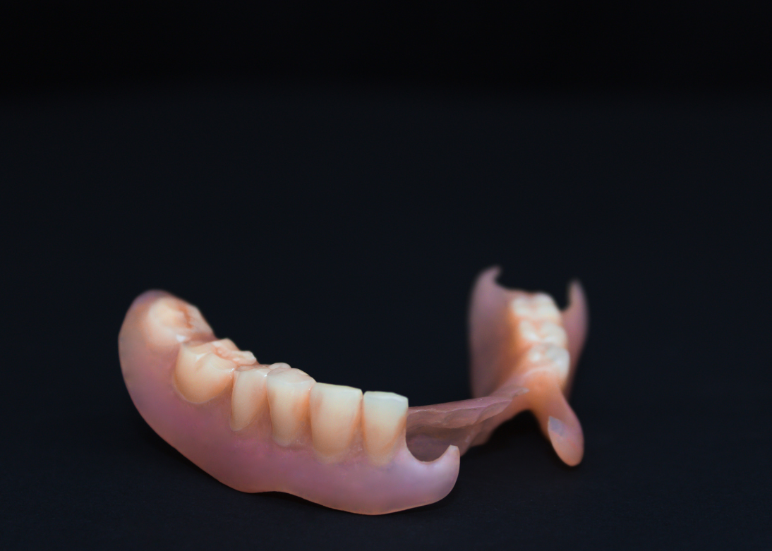 RPD (Removable Partial Dentures)